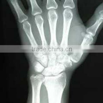 China Medical X-Ray Film KND-A/F CE