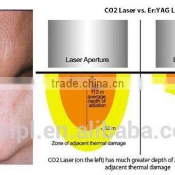 RF Co2 Fractional Laser Fractional Laser Treatment photo-3