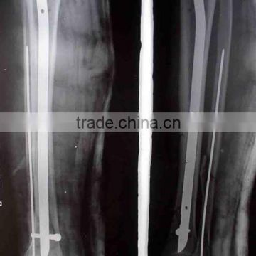 alibaba manufacturer x-ray thermal film, alibaba prices of agfa x-ray film 10x12