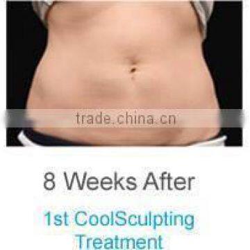 Sincoheren SCV-102 Model Coolplas Cryo Fat Freeze Slimming Machine