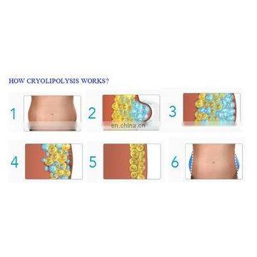 2019 Double Cryo Liplysis Fat Freezing Cryo Lipolysis Slimming Device for Fat Reduction