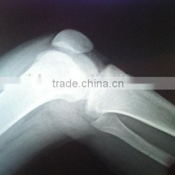 x ray blue film, medical x ray film, free sex china film