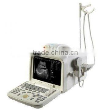 High Sensitivity 10" monitor Digital Ultrasound Scanner, Economical Model