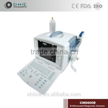 china super link bestsale fine link Digital Non-Interlaced portable ultrasound scanner 200D with low price