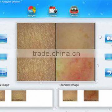 Professional Skin Analyzer Portable Skin Analyzer With CE