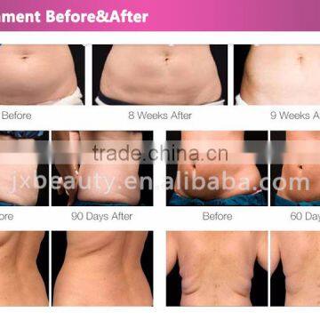 Cavitation Slimming Machine photo-6