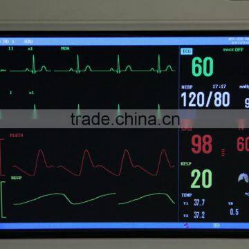 Low Cheap Portable 6 Parameter ECG/NIBP/SPO2/PR/TEM/REP 8-inch Patient Monitor With Optional Printer CE/ISO photo-5