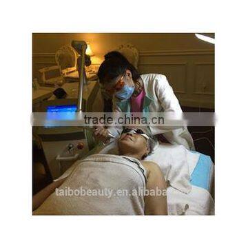 Laser Tattoo Removal/q-switched Laser Price Pigment Tattoo Removal/q Switched nd Yag Eyebrow Removal