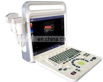 Hot Selling Medical Cheapest-portable-ultrasound-machine for Hospital and Clinic Use photo-4