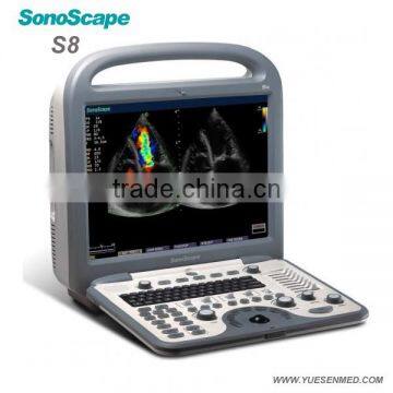 medical 4d portable color ultrasound Sonoscape s8