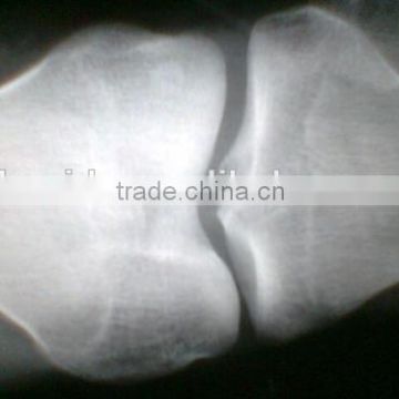 X ray film dry film, medical equipment from Chinese manufacturer