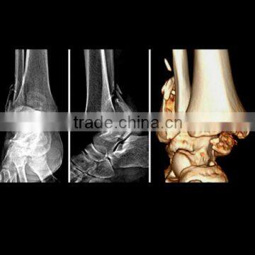 Fuji medical x-ray imaging film