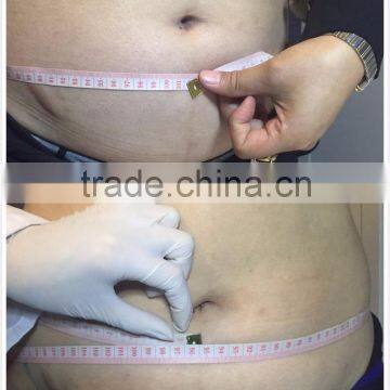 2016 Best Selling Liposonix Slim Beauty Equipment photo-6