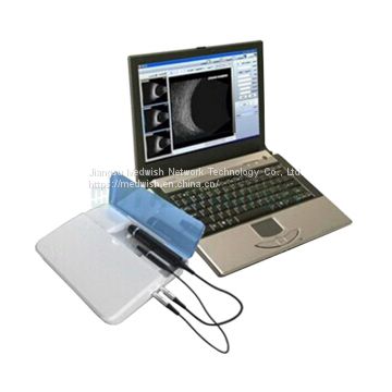 AG-BU006 China Hospital Ophthalmology Color Doppler Portable Ultrasound Scanner