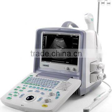 Portable ultrasound machine best price EM--2000