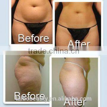 Good and Excellent Multifunction Cavitation Machine for Hospital ,beauty Spa ,clinic and Family photo-6