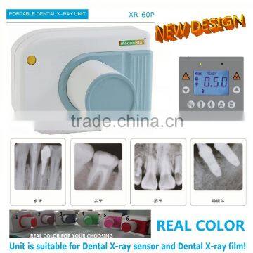 High frequency digital portable x-ray unit many colours