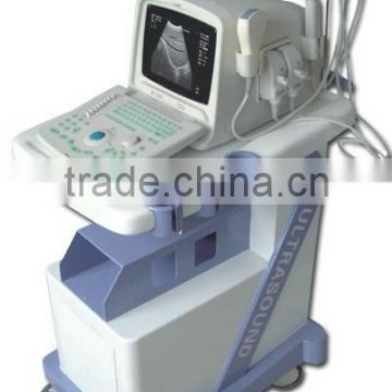 MCSS-6Portable Ultrasound Scanner