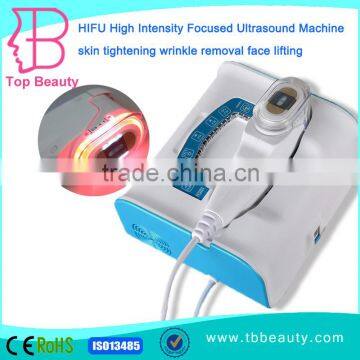 Forehead Wrinkle Removal Mini High Intensity Focused Ultrasound Machine Deep Wrinkle Removal Portable Hifu For Sale Pain Free