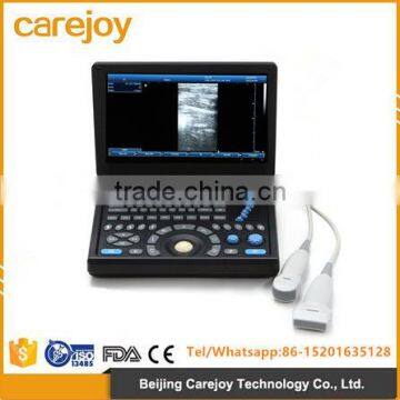 2016 new laptop ultrasound scanner (PC system) with CE & ISO certificate