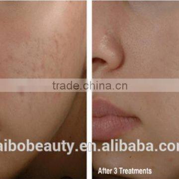 Skin Microdermabrasion Diamond Peeling Micro Dermabrasion Face Cleaning Machine photo-6