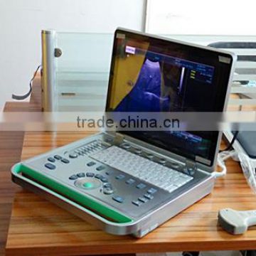 Price Of Ultrasound Machine & Ultrasound Scanner Portable                        
                                                Quality Choice