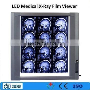 LED x ray accessories, medical negatoscope, x-ray film viewer