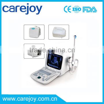 2016 Promotion!!CE approved Portable Ultrasound Scanner with 3.5Mhz multi-frequency convex probe RUS-9000A