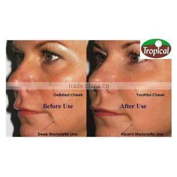 Virgin Coconut Oil for Skin photo-6