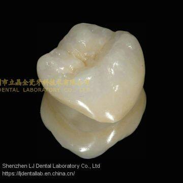 Dental crown 3M Lava zirconia, dental teeth, dental prosthesis, laboratoire dentaire, Dentallabor, laboratorio dental, dental laboratory, Shenzhen LJ dental lab China
