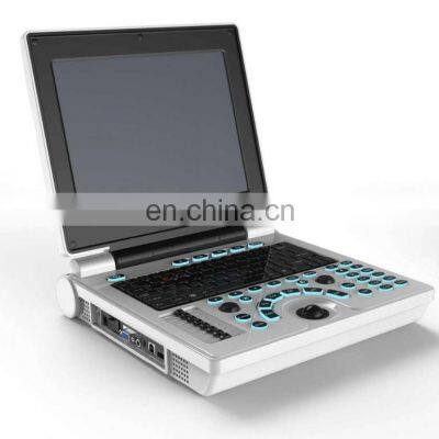 Medical equipment laptop black and white medical latest ultrasound machine color doppler ultrasound for hospital