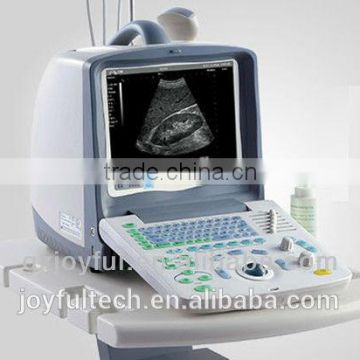 Ultrasound machine china for pregnancy testing