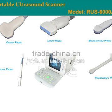 1 USB Factory Price OEM Design 80 Elements R60 Ultrasound Scanner for Pregnancy photo-6