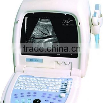 cheap trolley portable ultrasound machine price