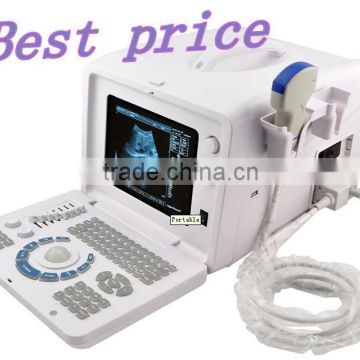 Good price Full Digital Portable Ultrasound Scanner RUS-6000D with linear transvaginal convex microconvex probe