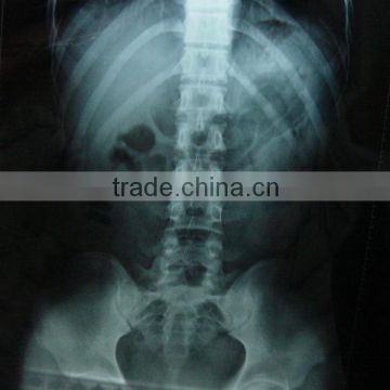 medical ray equipment/accessory, CT film,medical x ray film