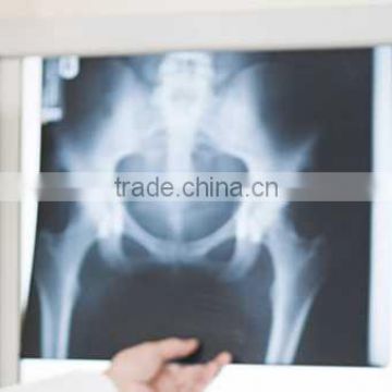 best selling china medical price list x-ray blue films