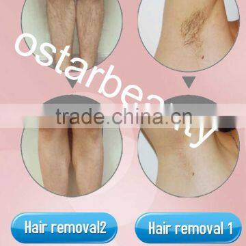CE Approval 808 nm Wavelength Hair Removal Laser DH 04 photo-6