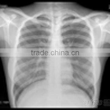 Medical Manufacturer Made in China Supplier for Hospital Dry Film Japan Film photo-6