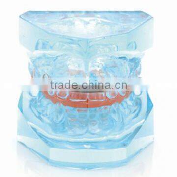 2015 hot sale orthodontic teeth model/Dental teeth model