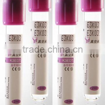 EDTA K2 vacuum blood collection tube