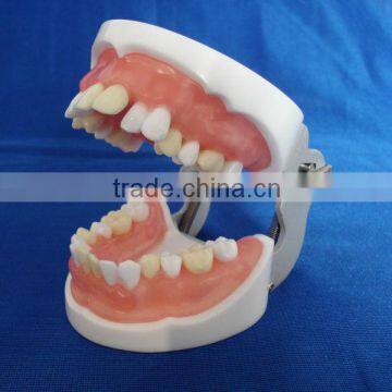 typodent dental jaw model for practice extract tooth