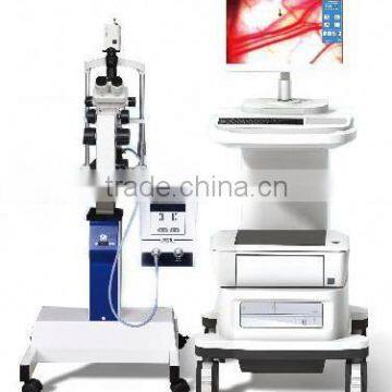 biological microcirculation microscope nail-fold capillary microscope with high performance