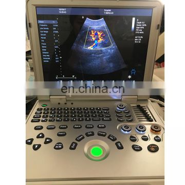 Cheapest price MY-A024B-N Medical Portable Digital 4D Color Doppler Ultrasound Machine with CW function