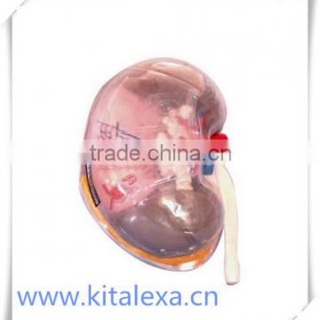 Transparent renal segment model KA-TP0005