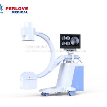 C arm x-ray radiology system PLX112E