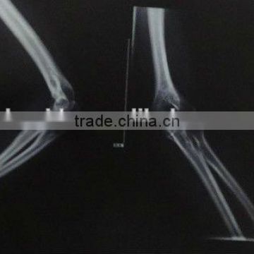 Imaging medical ray film,digital x-ray cr,fuji x-ray film sale from Chinese manufacturer