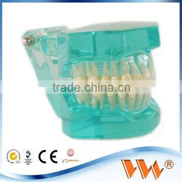 Popular Transparent Plastic Pathologic Dental Implant Model for study