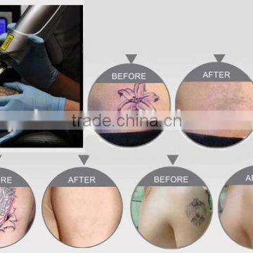 Multifunction Yag Laser Hair Removal Multi-languages Large Spot Size With Russia Imported Rod photo-3