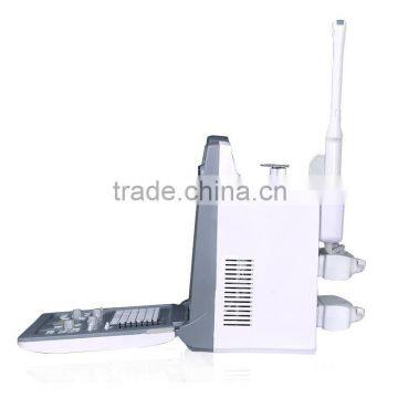 Promotion Price Cheapest 3D Laptop Color Doppler Ultrasound/doppler Ultrasound photo-6